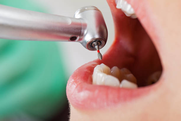 Best Dentist for Tooth Abscess  in Wake Forest, NC